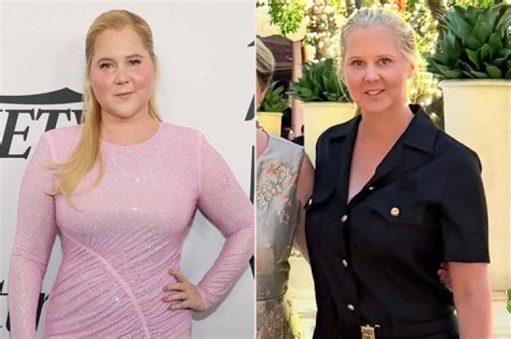 All About Amy Schumer's Parents: A Detailed Look