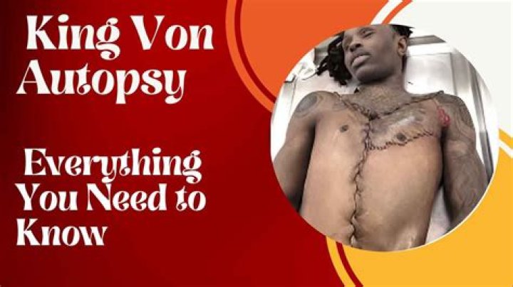 Autopsy Leaks Expose Truths About Rappers' Lives