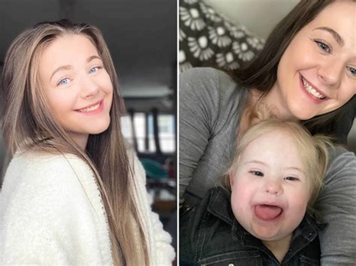 George Clooney's Twins Diagnosed With Down Syndrome