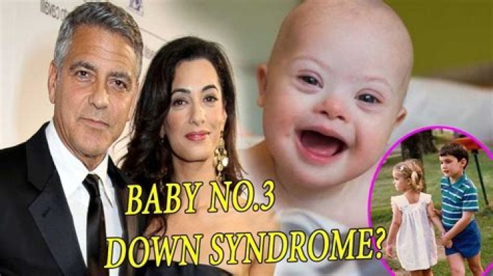 Is One Of George Clooney's Twins Down Syndrome? - Ultimate Guide