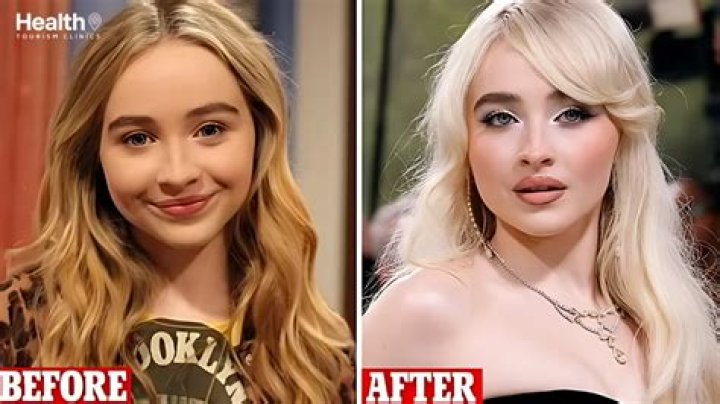 Sabrina Carpenter's Plastic Surgery: Before And After Transformation