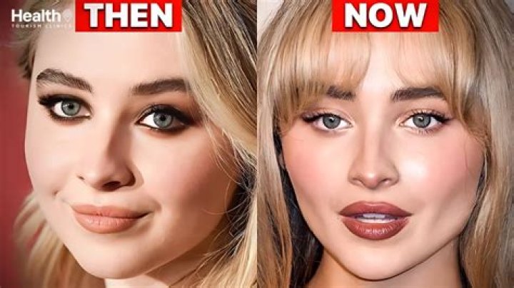 The Unfiltered Truth About Sabrina Carpenter's Plastic Surgery Rumors