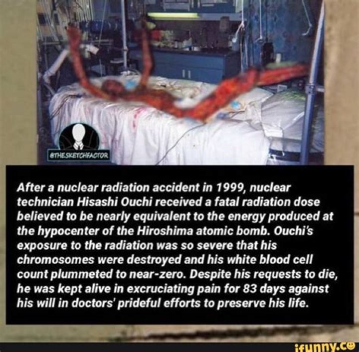 Tragedy Of Hisashi Ouchi: Radiation Burns Aftermath