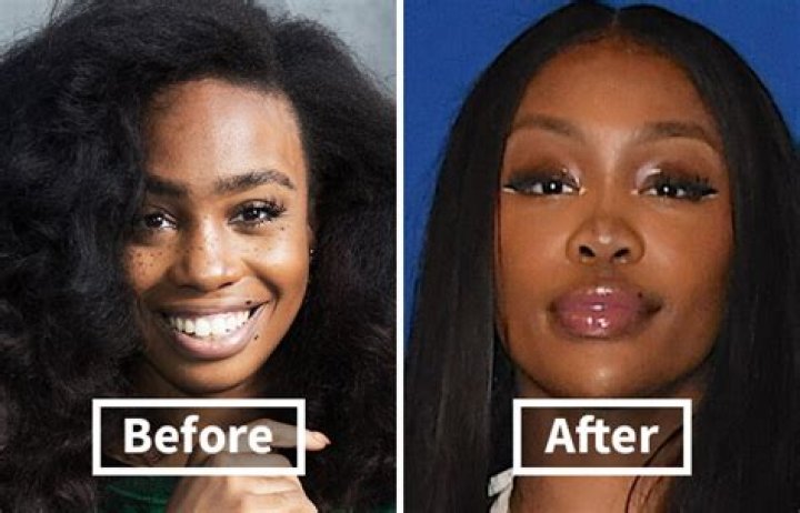 Unveiling SZA's Transformation: The Pre-Surgery Saga